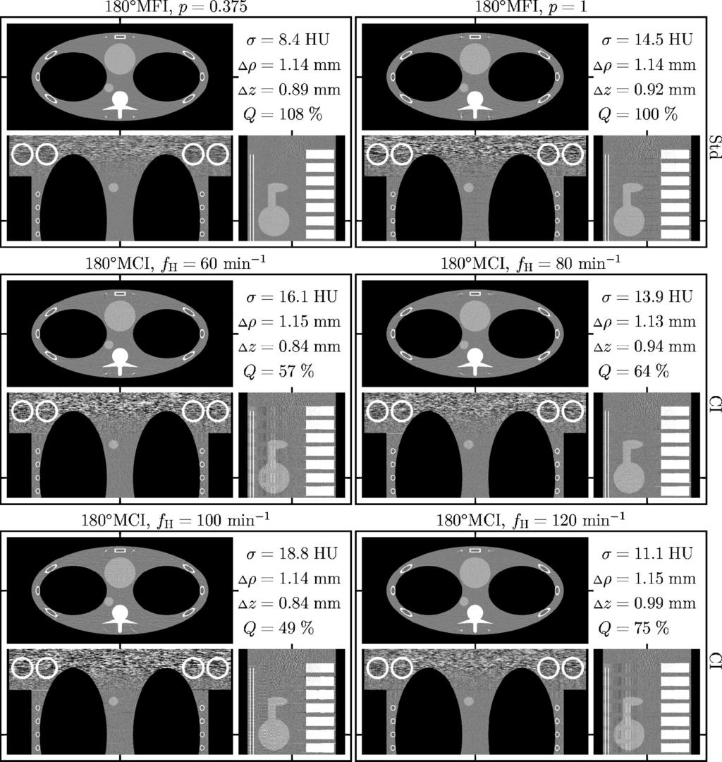 1629 Kachelriess, Knaup, and Kalender: EPBP for CBCT 1629 FIG. 5. Gold standard four-slice image reconstruction applied to four-slice data. The cardio data were simulated with p 0.375.