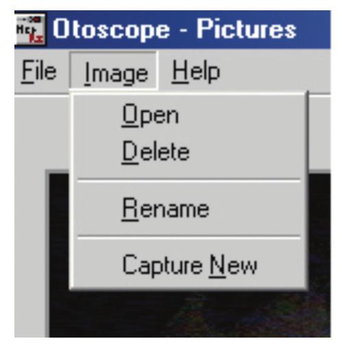 OPEN: Click on the Open button to open the selected picture and view it on a separate screen where it can be zoomed-in or enhanced