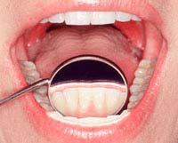 Phys 14: College Physics Spring 21 4) 2 A dentist holds a small mirror 1.9 cm from the surface of a patient s tooth. The image is upright and 5. times larger than the tooth.