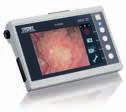 Imaging Systems for use with the mobile video cystoscope with CMOS-chip technology, C-VIEW 8403 ZXK C-MAC Monitor for CMOS Endoscopes, screen size 7" with 1280 x 800 pixel resolution, two camera
