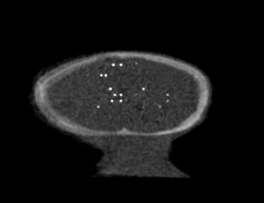 Blob size Fig. 5. Blob phantom study. (Left): a row of blobs of decreasing size extends diagonally across space.