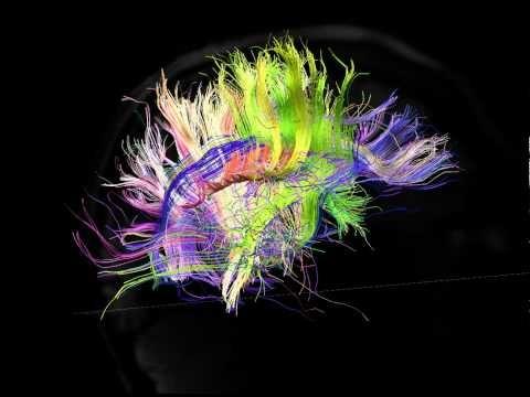 Diffusion Tensor Imaging data from the Human Connectome Project Source: