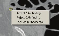Chapter 4: User scenarios Check CAR findings Select the CAR tab If required, adjust the Sphericity Threshold to display CAR findings