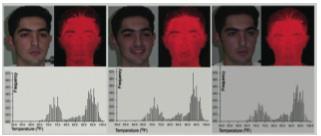 Figure 4 Candide-3 Figure 5 Infrared Recognition [6] 4. Future Work As in figure 4, additional techniques are being used to detected facial expressions.