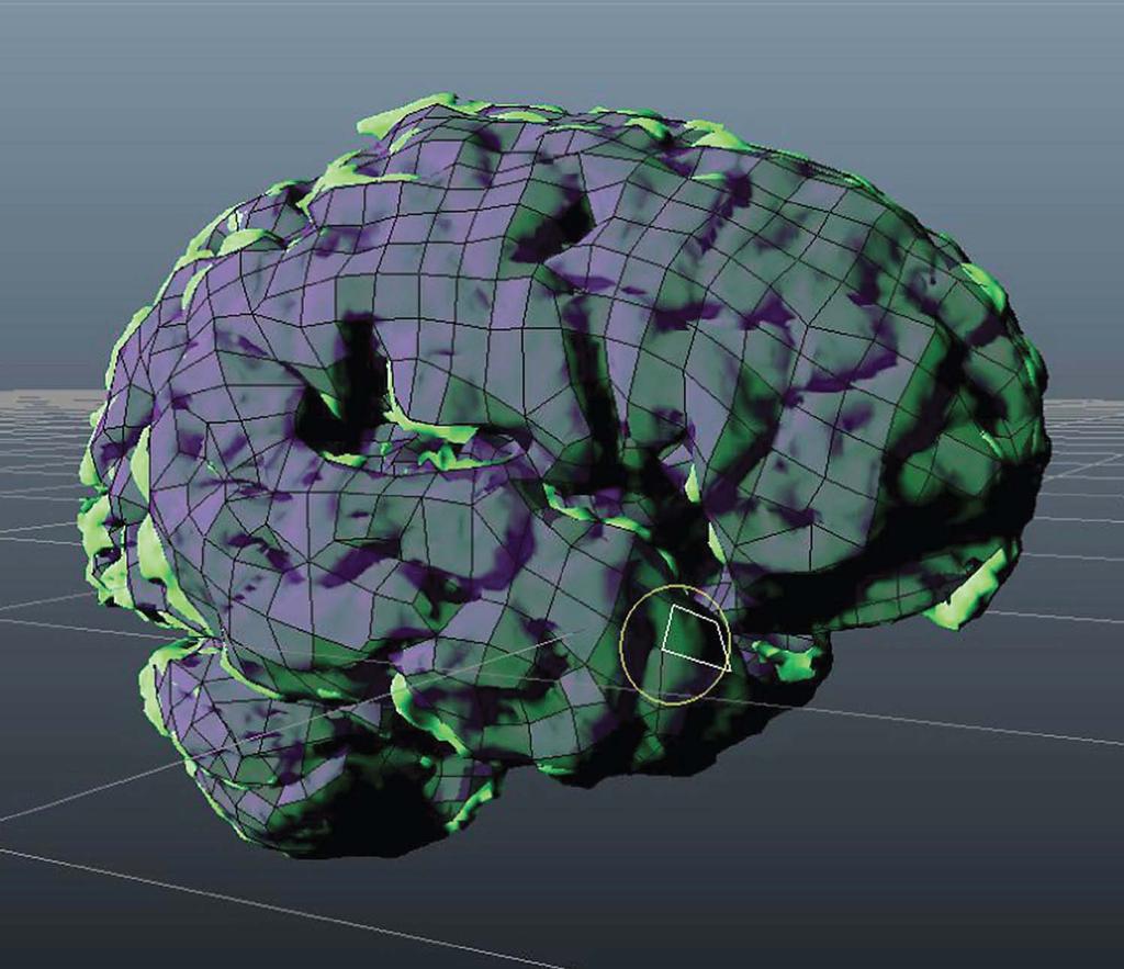 Cleaned up brain model. Figure 6.