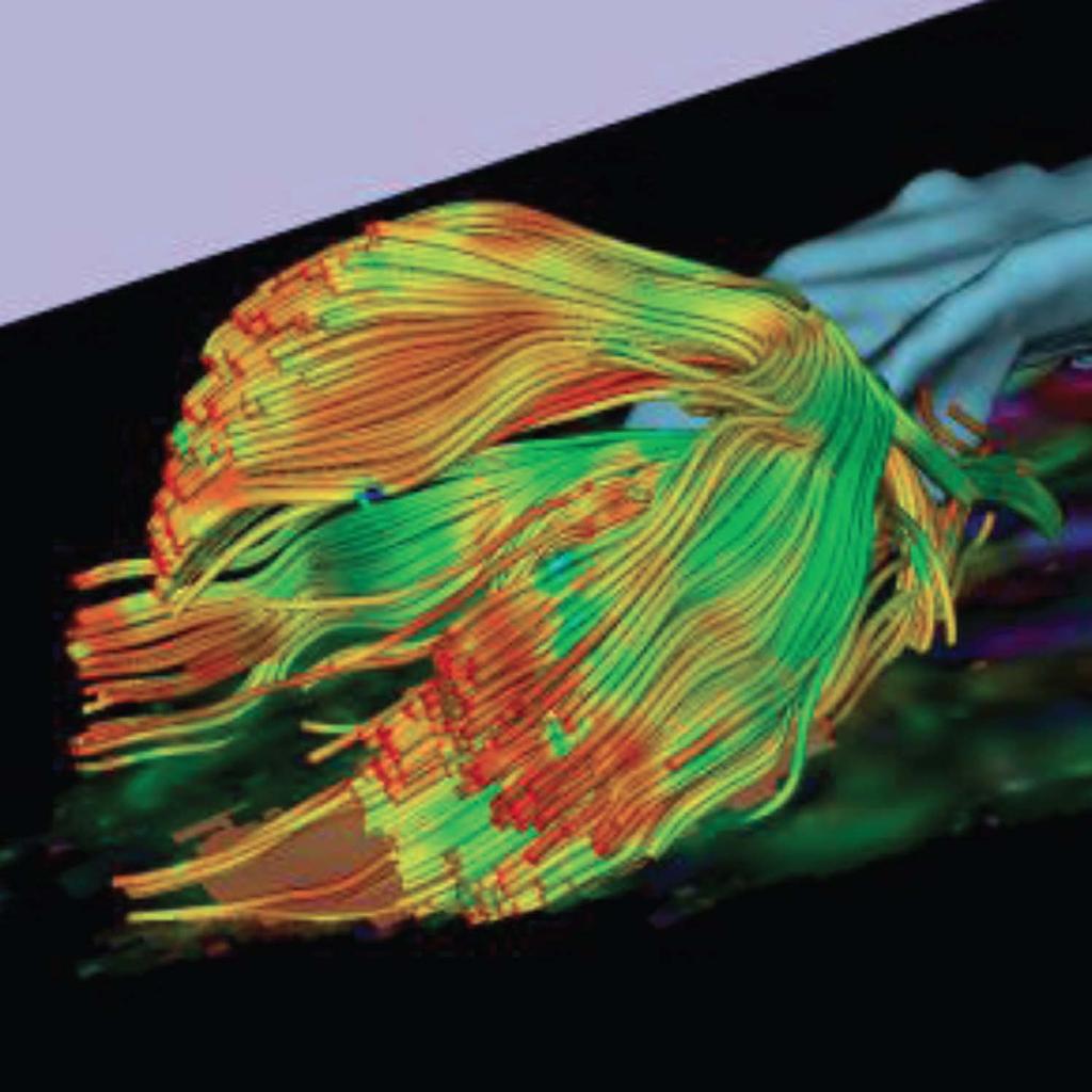 Figure 7. Screen capture of DTI image from 3DSlicer - Close up three-quarter view of tractography and brain ventricles displayed as volume models.