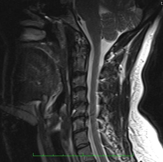 Additional Images (Interesting Findings) During the study, disc