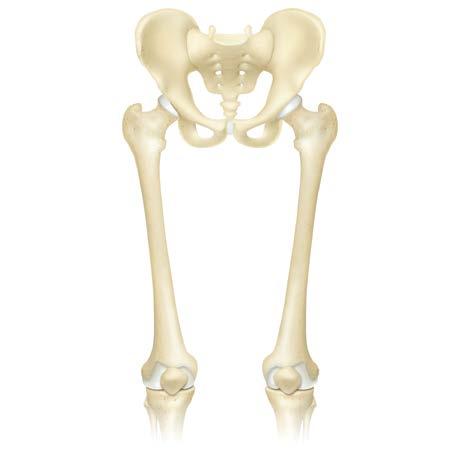 Primary or Revision Hip/Acetabulum Replacement Femurs must be positioned so they are parallel to the horizontal plane of the table. Patient needs to be in A/P position with feet inverted.