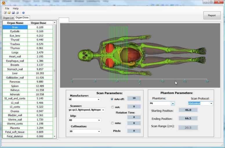 VirtualDose, A New Software for CT Dose Reporting - A easy to use graphical user interface