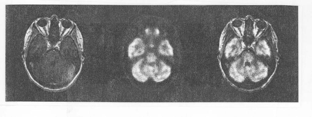 -24- (MRI provides anatomic