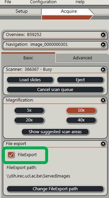 Press the Edit key to set up the file export options: Export after Overview and Scan: to export automatically.