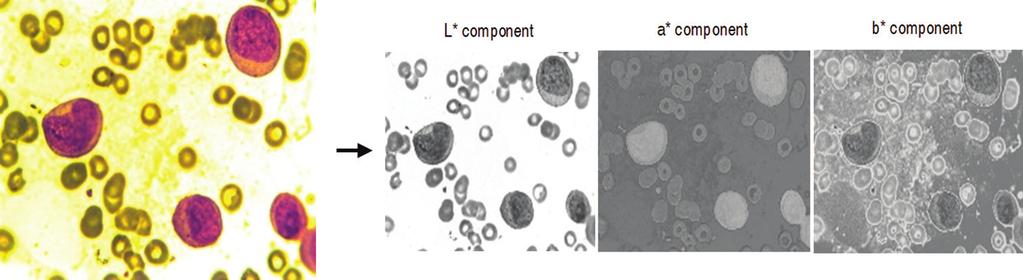 Figure 6: The result of RGB to CIELAB conversion Table 1: Result of Hausdorff dimension Cancerous image (myeloid blast) Noncancerous image (mature myelocyte) Figure 7: Segmentation result roughness