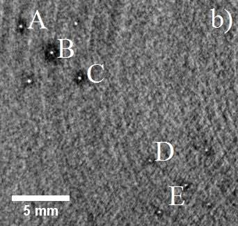 Microcalcification clusters with CaCO 3 specks of 160 μm and 130 μm in the images without phase retrieval (a) and with phase-retrieval (b).
