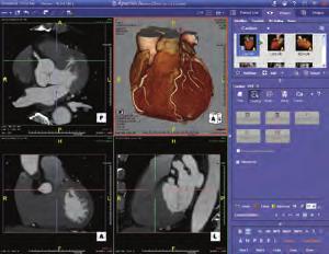 16,000 images Also accepts DVD-RAM, DVD-R and CD-R/RW TeraRecon intuition Workstation/Server To enhance SCENARIA s clinical and workflow capabilities