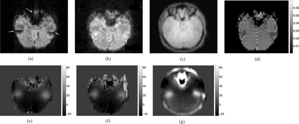 432 IEEE TRANSACTIONS ON MEDICAL IMAGING, VOL. 28, NO. 3, MARCH 2009 Fig. 8. Experimental results with the second subject.