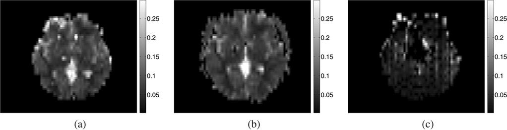 NGUYEN et al.: JOINT ESTIMATION AND CORRECTION OF GEOMETRIC DISTORTIONS FOR EPI FUNCTIONAL MRI 433 Fig. 9.