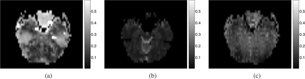 Dynamic imaging study with the second subject: normalized root mean squared error (NRMSE) map for (a) HR image reconstruction; (b) DFT image reconstruction; (c) HR T map reconstruction.