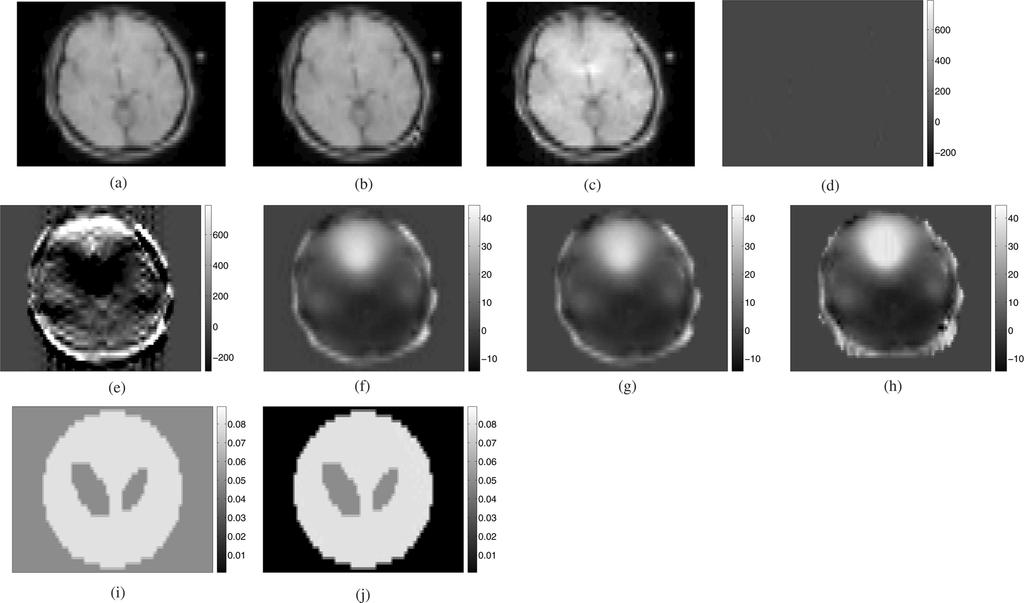 NGUYEN et al.: JOINT ESTIMATION AND CORRECTION OF GEOMETRIC DISTORTIONS FOR EPI FUNCTIONAL MRI 429 Fig. 5. Simulation 1: reconstructions. All scales of field maps are in Hz.