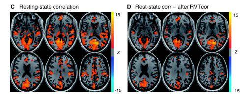 When? Literature Evidence! Resting-state:! Birn, R. M. The Role of Physiological Noise in Resting-state Functional Connectivity. NeuroIage 62, 2012! Birn, R. M., et al.