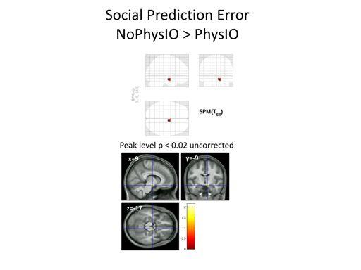 When? PhysIO experience! Andreea Diaconescu (TNU): Social Learning! Higher sensitivity for group effects (N=35)!