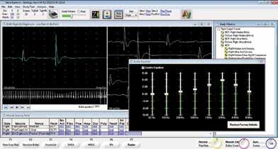 Software Standard EMG protocol includes both Live and Capture data acquisition modes with easily accessible muscle scoring table and audio equalizer