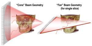 Feldkamp (FDK) algorithm makes CBCT reconstruction possible Generalization of the fan beam