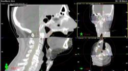 8/3/26 IGRT using CBCT 25 CBCT is the most accurate IGRT technique for IGRT for its true