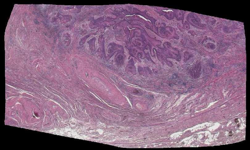 Two HE-stained histological slices