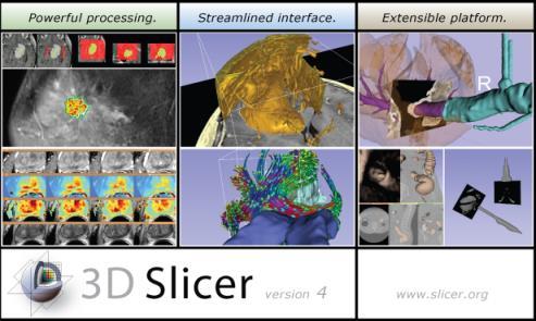 Background for 3D Slicer Software application for medical image computing: data