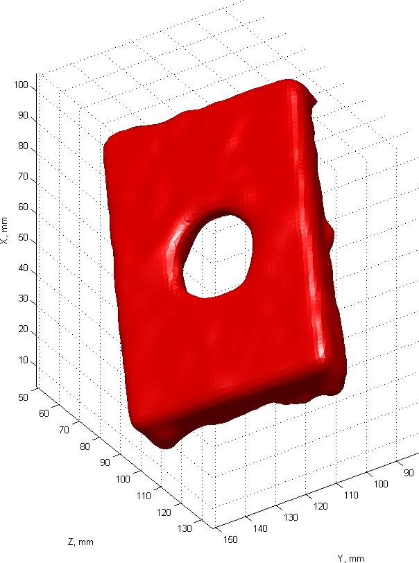Construction of 3D grid Segmentation of phantom Results The volume of the phantom calculated according to physical measurements of the caliper, was assumed as a true value V true = 47.054 ml.