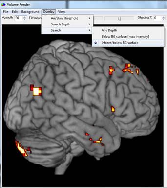 can control how much activations are brought to the surface under Overlay -> Search Depth. Finally, we can peel back chunks of the brain to observe activations lurking in inner structures.
