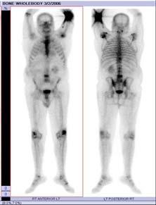 results against baseline values Clinical SPECT/CT Imaging