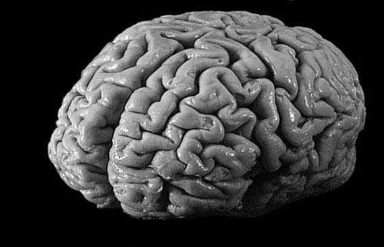 Human Brain Artificial Neural Network f 1 f 2 f 3 f 4 Class f 5 f 6 f 7 Fully