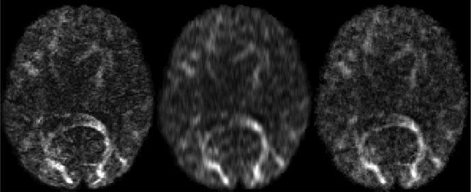 Holistic Image Reconstruction for Diffusion MRI 35 Implementation Details The operators F ;2, S (6), ODF (0), G b (), r y and Δ S 2 are linear.