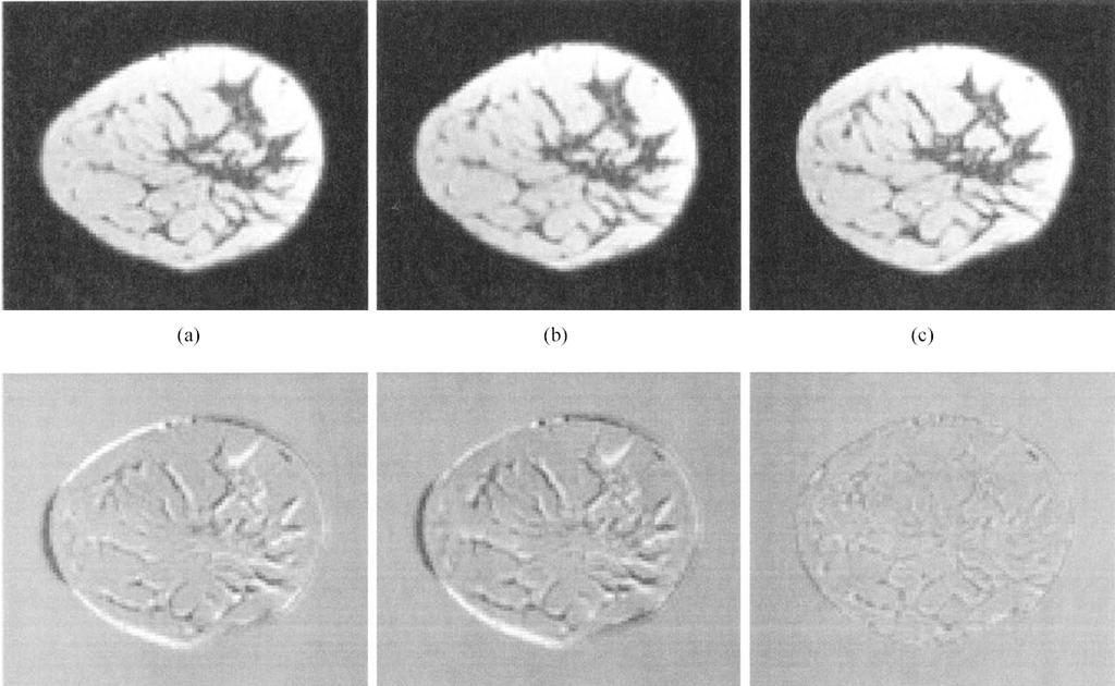 Breast MRI without contrast agent Registration
