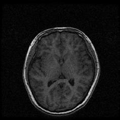 tissue deformation Breast MRI Liver MRI Brain shift