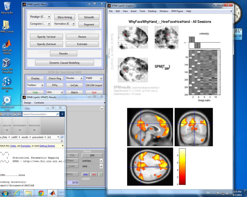 of time courses Overlays Superimpose results on other images Then displays MIP Current