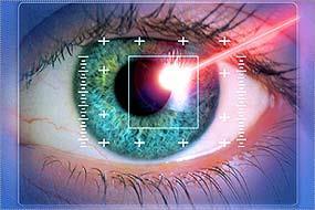 23 Biometric Is the technology of authenticating