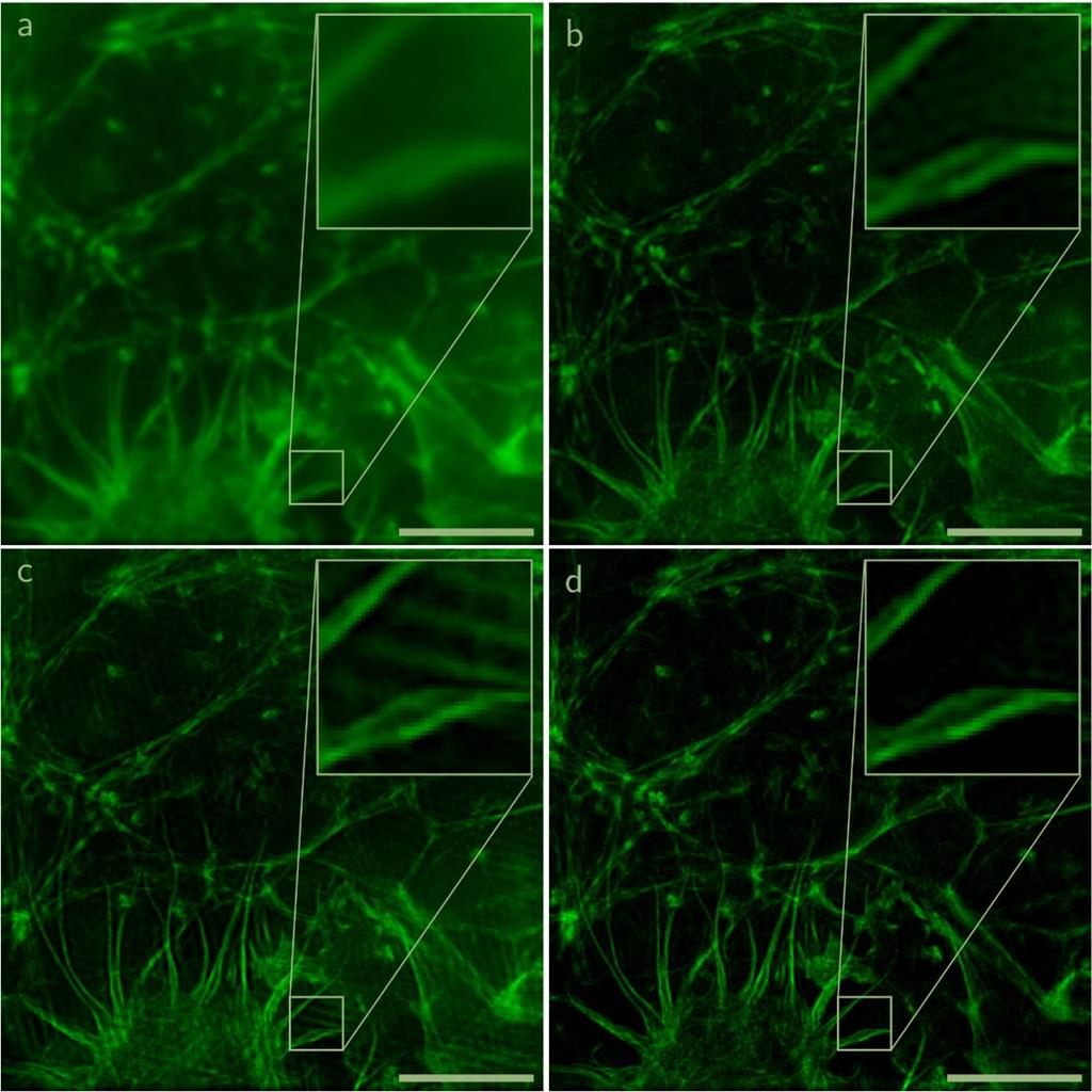 Effect of OTF attenuation on single-slice SR-SIM reconstruction Supplementary Figure 1: Actin filaments in U2OS cells, labelled with Phalloidin-Atto488, measured on a DeltaVision OMX, excited at 488