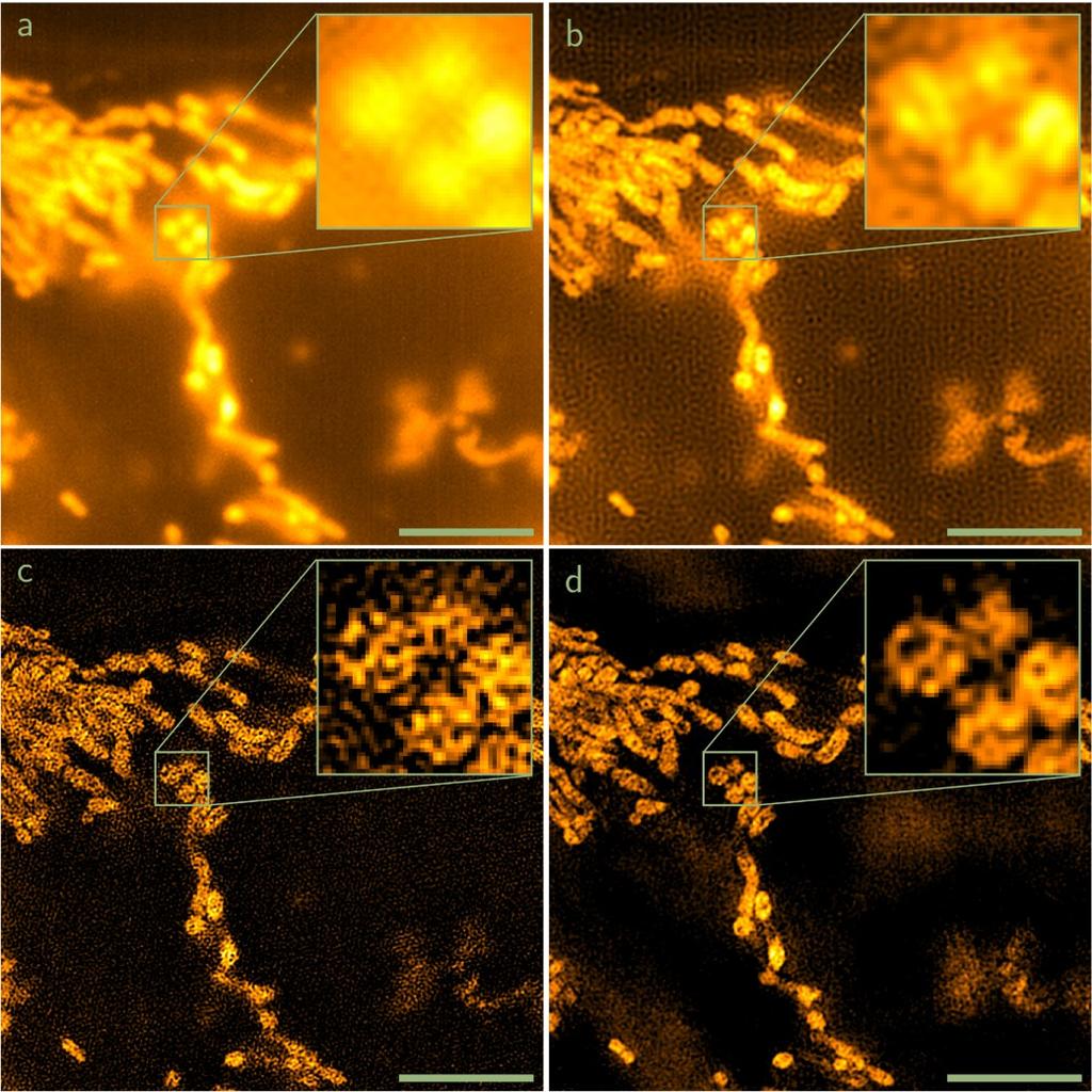 SR-SIM of mitochondria in U2OS cells Supplementary Figure 4: Mitrochondria (Mito-Tracker) in U2OS cells, DeltaVision OMX, excited at 568 nm wavelength.