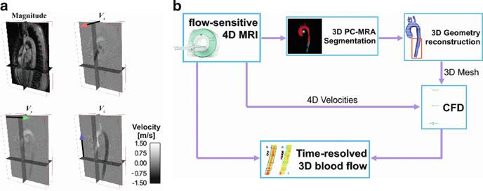 28 A.F. Stalder et al. Fig. 1 (a) 3D flow-sensitive MRI includes anatomy and three-directional velocities over a 3D volume.