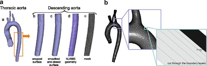 The segmentation of the arteries was performed on the 3D PC-MRA data using level-set active contours (ITK-SNAP, Penn Image Computing and Science Lab, University of Pennsylvania, USA [6]).