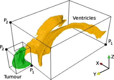 56 J. Ma et al. Fig. 3 The vertices P 1 and P 2 define a cuboidal box bounding the tumour or ventricles.