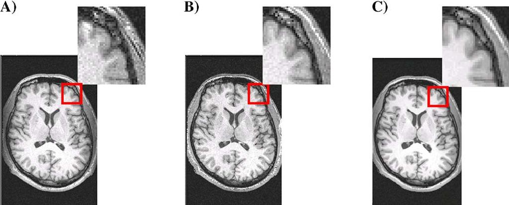 188 K.A. Clark et al. / NeuroImage 29 (2006) 185 202 Fig. 2. Data Acquisition. (A) Sample MPRAGE image. (B) Sample SPGR image.