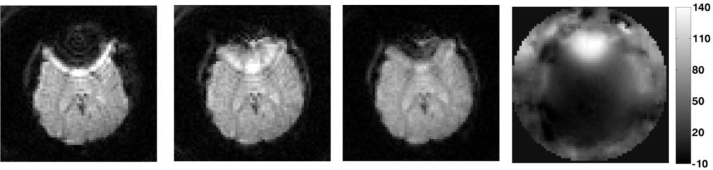 SUTTON et al.: FAST, ITERATIVE IMAGE RECONSTRUCTION FOR MRI IN THE PRESENCE OF FIELD INHOMOGENEITIES 187 (a) (b) (c) (d) Fig. 10.