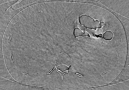 monochromatic images of an abdominal clinical scan at various energies.