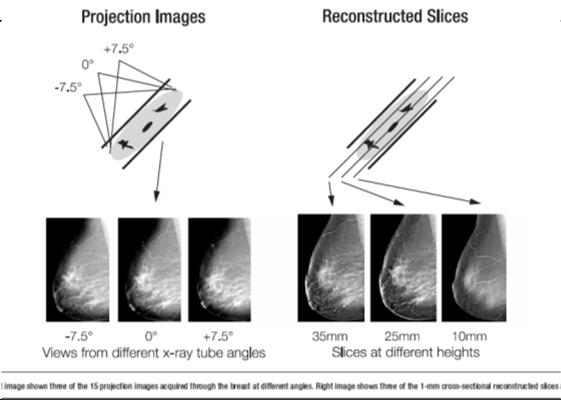 Modes of Acquisition Display The unit must perform existing 2D digital mammography images Tomosynthesis images must be able to be taken in all standard projections not just the CC and MLO Take a