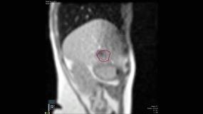 imaging Gated Radiotherapy