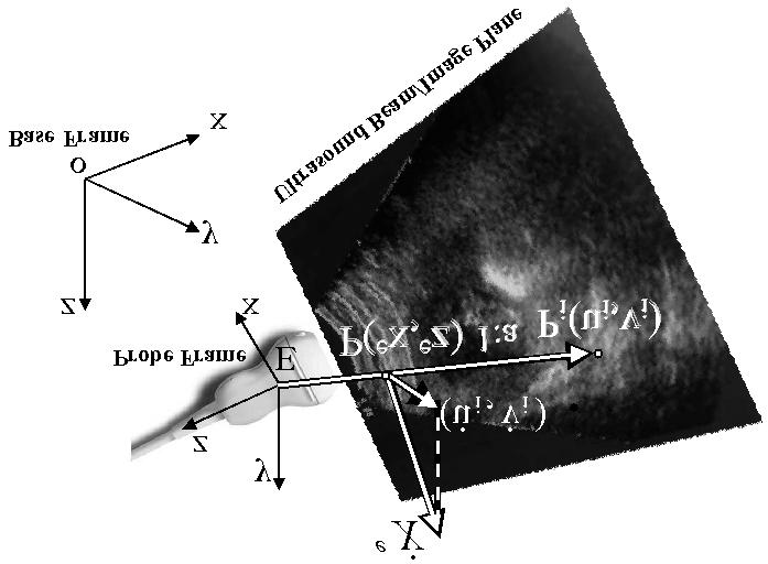 Figure 3: Definition of the frames for the ultrasound robot.