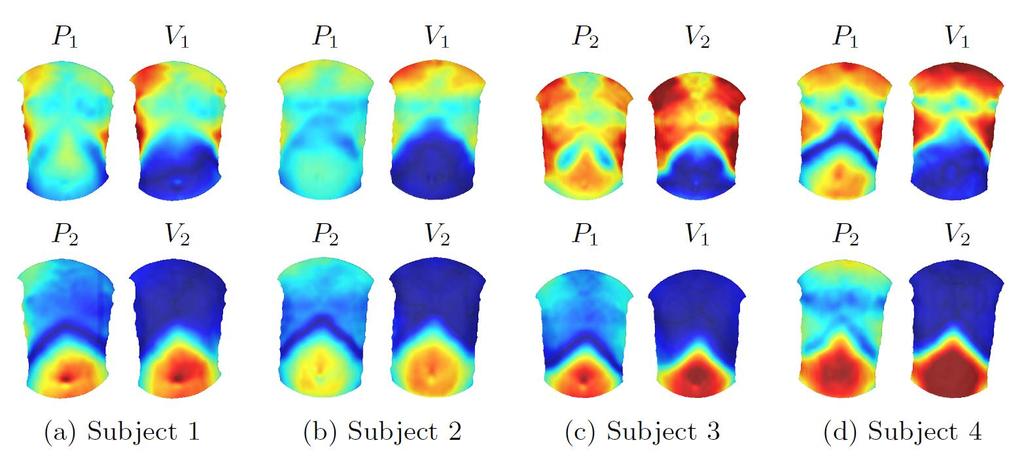 Results PCA vs. varimax rotations Figure: Respiratory motion patterns from statistical analysis.